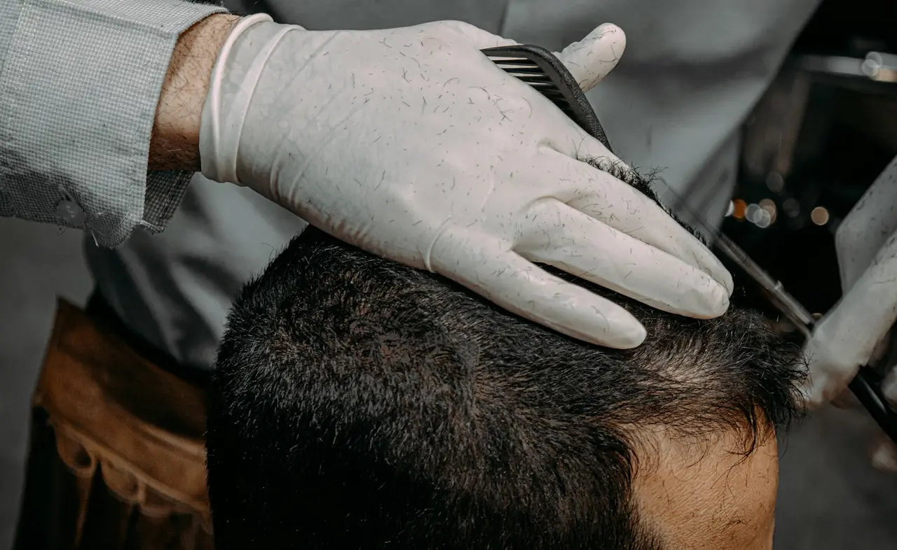 Norwood Scale Planning: Advanced Techniques for Hairline Design